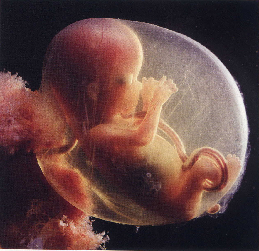 Female Foetus (File Photo)