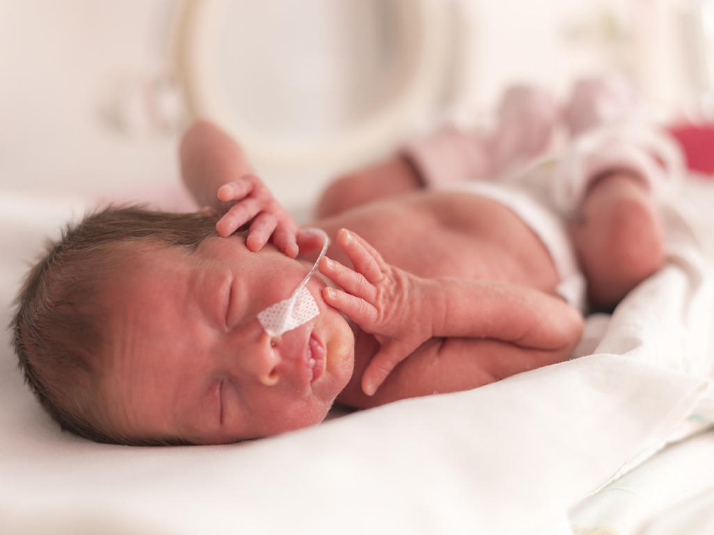 A premature infant has obstructive  sleep apnea risk