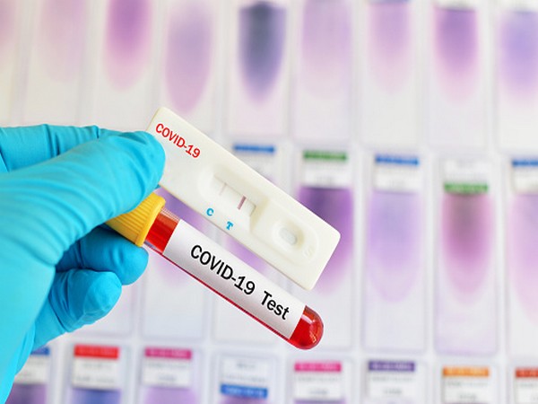 COVID-19 RT-PCR Testing Kit