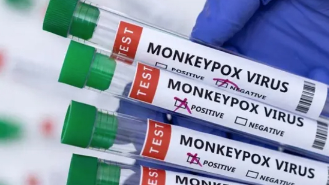 Over 550 confirmed monkeypox cases detected in 30 countries (File Photo)